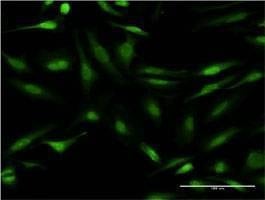 Anti-CALCOCO2 Antibody