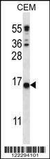 Anti-CJ057 (C-term) Antibody