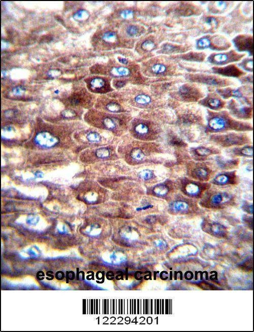 Anti-CJ057 (C-term) Antibody