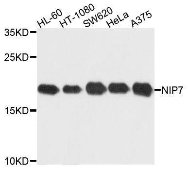 Anti-NIP7 Antibody
