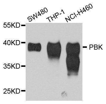 Anti-PBK Antibody
