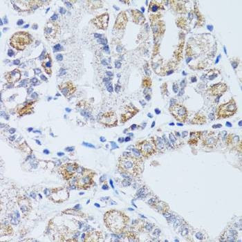 Anti-DNAJC19 Antibody