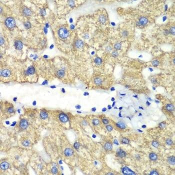 Anti-ABAT Antibody