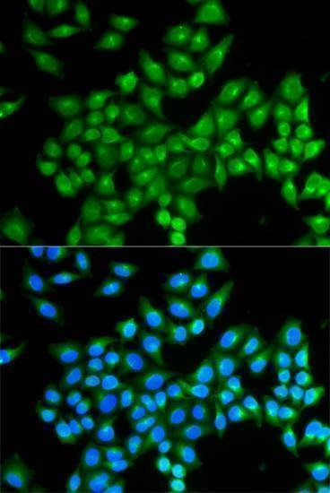 Anti-DAO Antibody