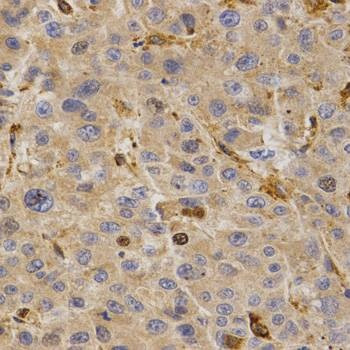 Anti-GHRH Antibody