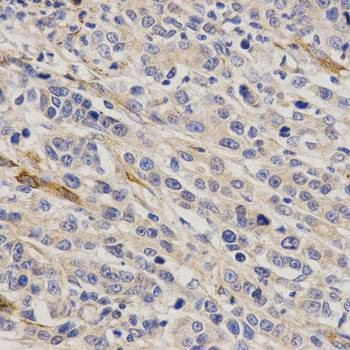 Anti-GHRH Antibody
