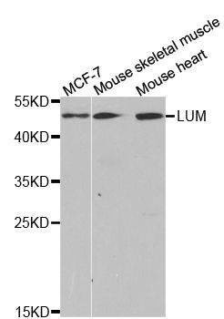 Anti-LUM Antibody