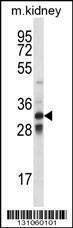 Anti-Mouse TLX1 (Center) Antibody