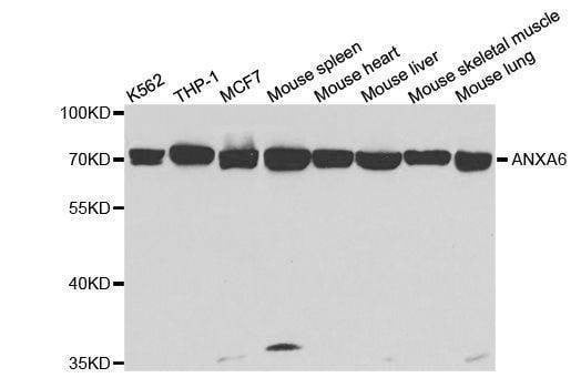 Anti-ANXA6 Antibody