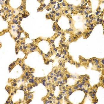 Anti-ANXA6 Antibody