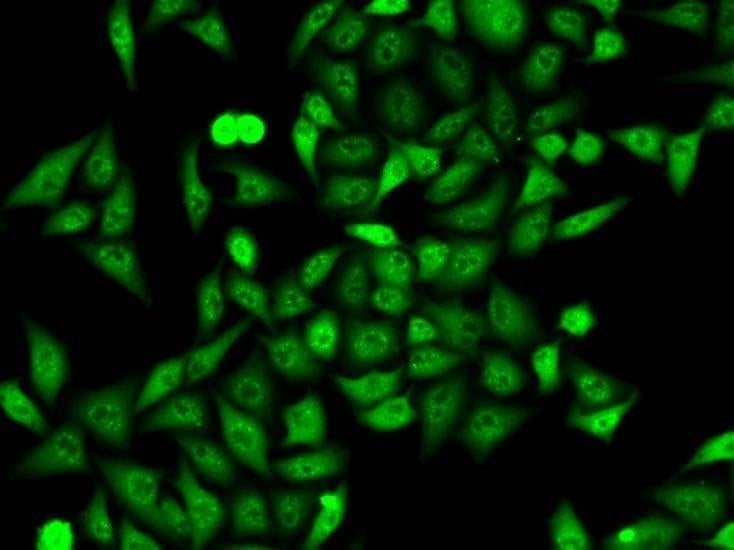Anti-ANXA6 Antibody