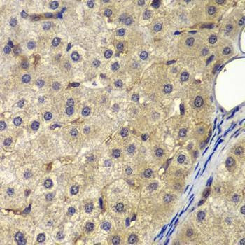 Anti-AP2A2 Antibody