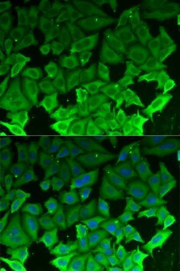 Anti-EEF2K Antibody
