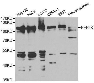 Anti-EEF2K Antibody