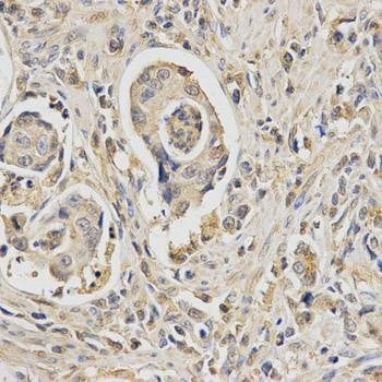 Anti-HUS1 Antibody