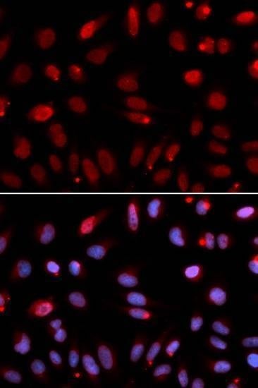 Anti-HUS1 Antibody