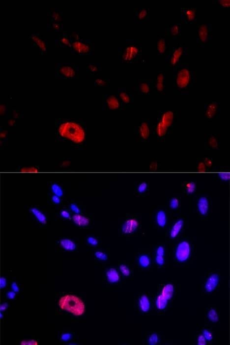 Anti-HUS1 Antibody