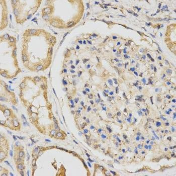 Anti-PCCB Antibody