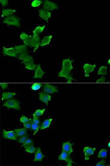 Anti-GLUL Antibody