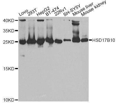Anti-HSD17B10 Antibody