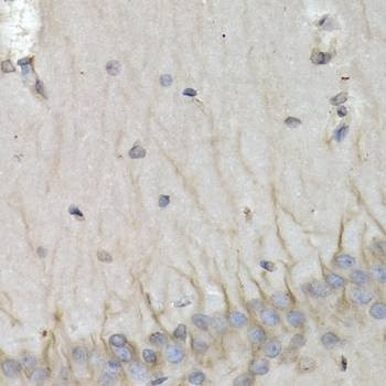 Anti-PSMB10 Antibody