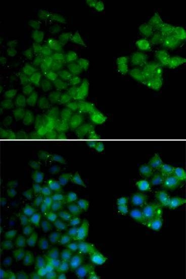 Anti-PSMB10 Antibody