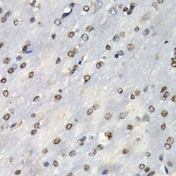 Anti-PSMB10 Antibody