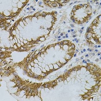 Anti-SIGMAR1 Antibody
