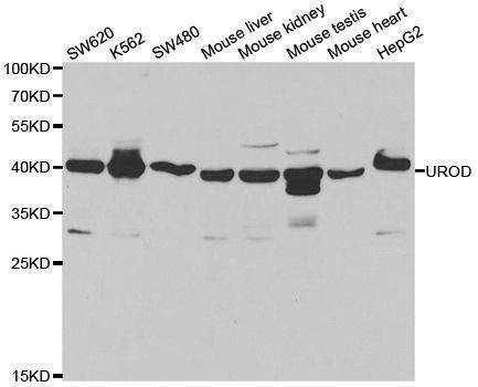 Anti-UROD Antibody