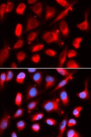Anti-UROD Antibody