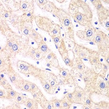 Anti-PSMF1 Antibody