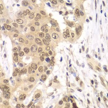 Anti-RNF2 Antibody