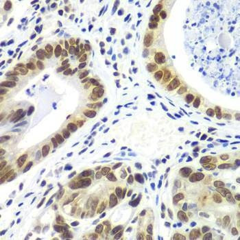 Anti-RNF2 Antibody