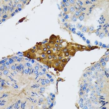 Anti-PGRMC1 Antibody