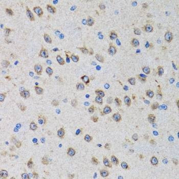 Anti-PGRMC1 Antibody