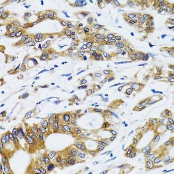 Anti-PGRMC1 Antibody