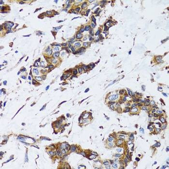 Anti-PGRMC1 Antibody