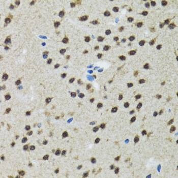 Anti-RAG2 Antibody