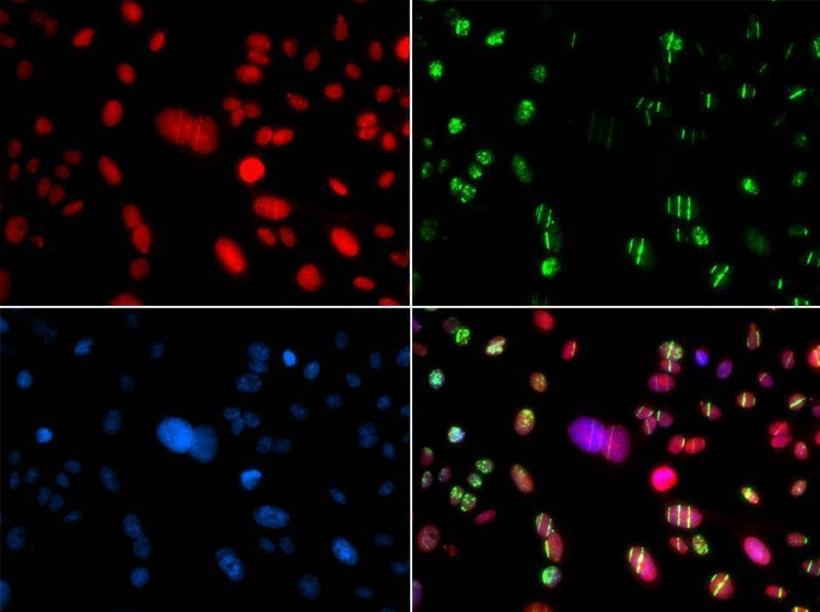 Anti-RAG2 Antibody