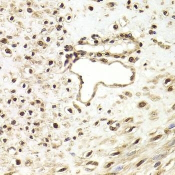 Anti-FKBP4 Antibody
