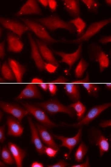 Anti-SMAD4 Antibody