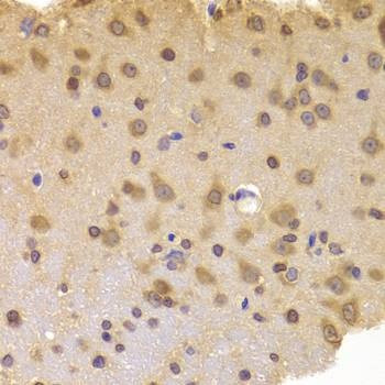Anti-ROCK2 Antibody