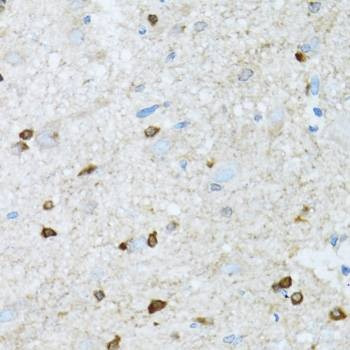 Anti-ROCK2 Antibody