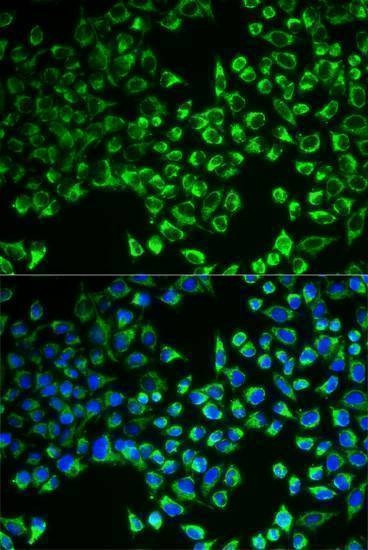 Anti-CS Antibody