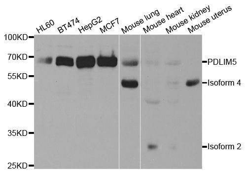 Anti-PDLIM5 Antibody