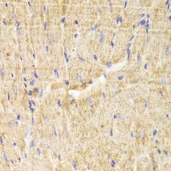 Anti-PDLIM5 Antibody