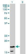 Anti-CALML5 Antibody