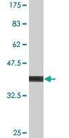 Anti-CALML5 Antibody