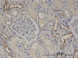 Anti-CALML5 Antibody