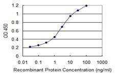 Anti-CALML5 Antibody